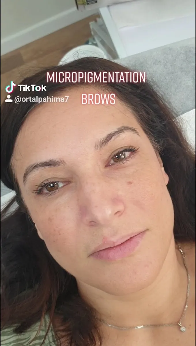 Ortal pahima - skin clinic, תמונה 4