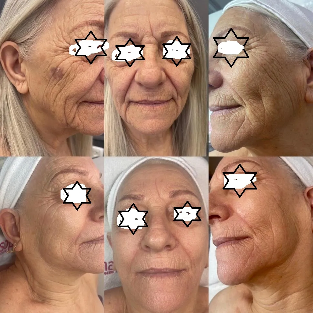 אמירה צדקיהו - קוסמטיקה פרא רפואית מתקדמת, תמונה 6