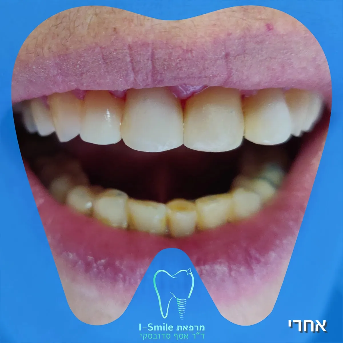 ד"ר אסף סדובסקי מרפאת שיניים בירושלים Dr.Sadovsky Jerusalem Dentist, תמונה 8