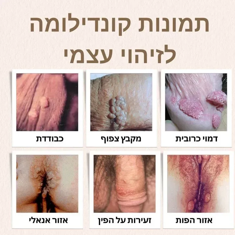 לייזר פרו, תמונה 4