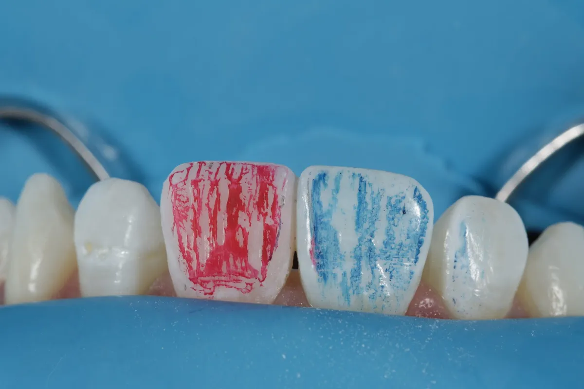 Aesthetic Dentistry - ד''ר אילן הכט, תמונה 5
