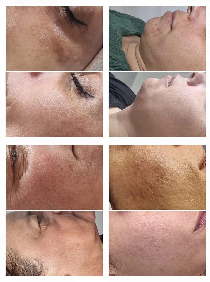 קוסמטיקאית שני גת לייזר Shani cosmetics, תמונה 6