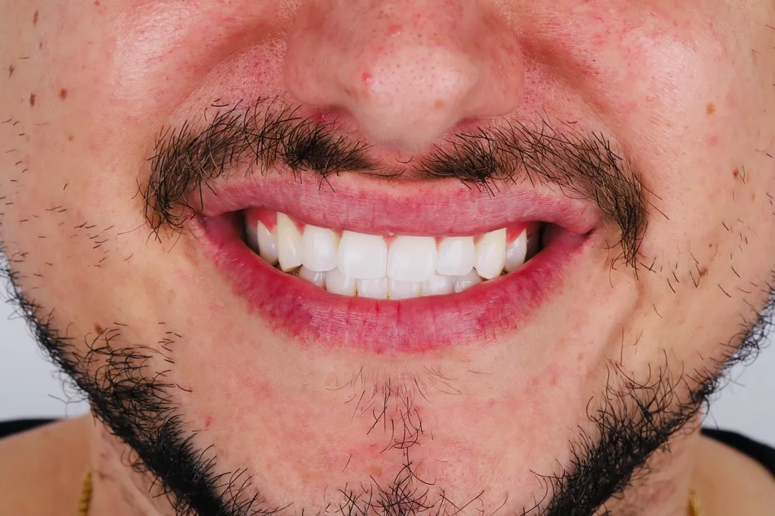 Aesthetic Dentistry - ד''ר אילן הכט, תמונה 4