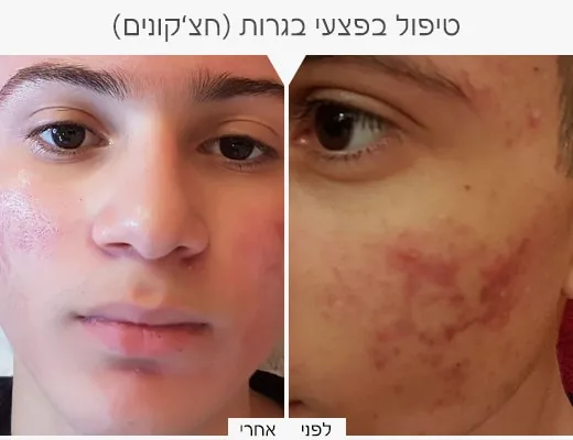 כרמי קוסמטיקה רפואית, תמונה 7