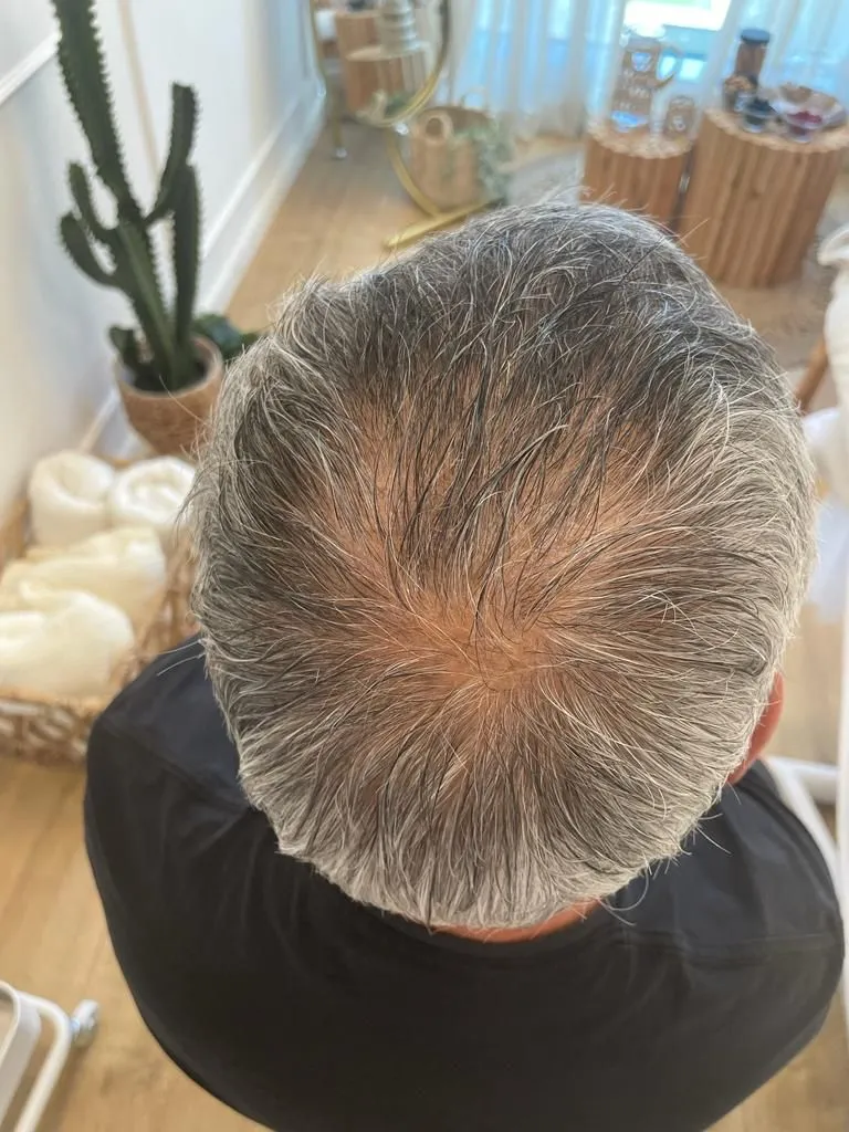 טליה דגן קוסמטיקה roof top (רחובות), תמונה 2
