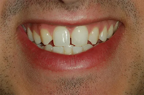Dr. Gal Rosen dental specialists: תמונה 6