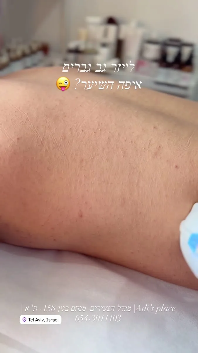 Adis place- עדי בוטיק קוסמטיקאית והסרת שיער בלייזר תל אביב, תל אביב–יפו, תמונה 6