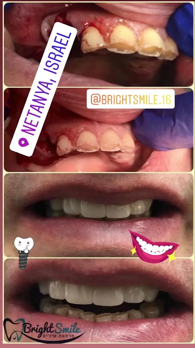 Bright Smile, תמונה 5