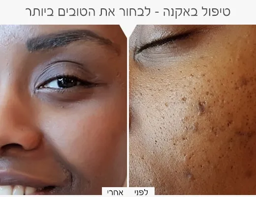 כרמי קוסמטיקה רפואית, תמונה 5