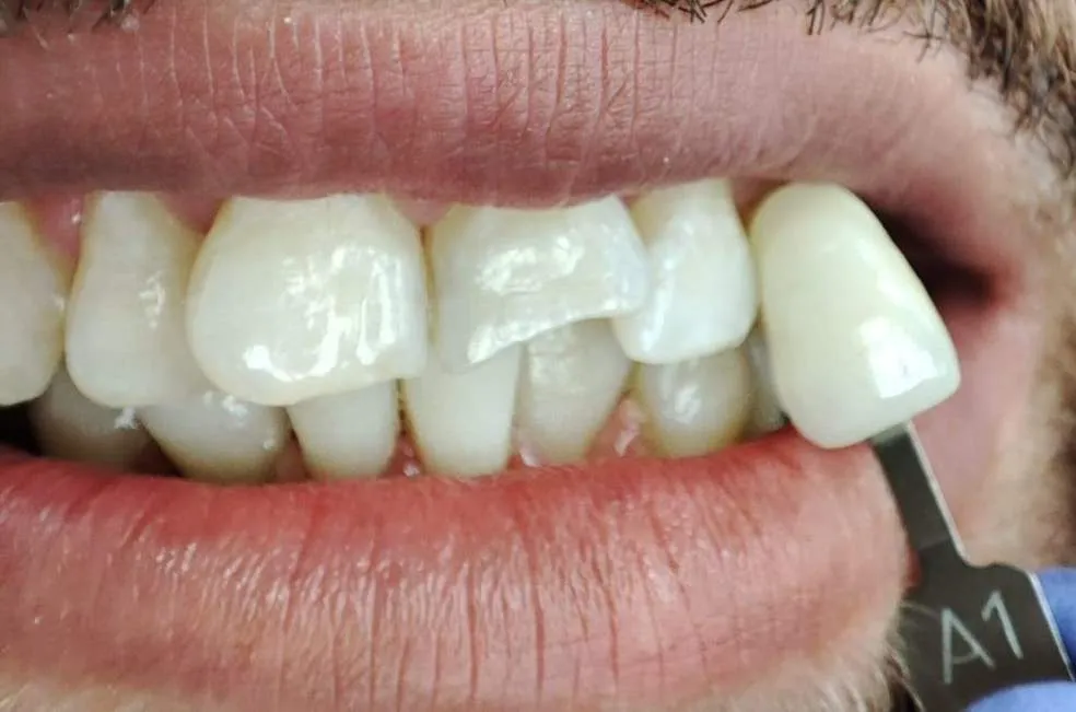 ODYNOKA dental clinic, תמונה 7