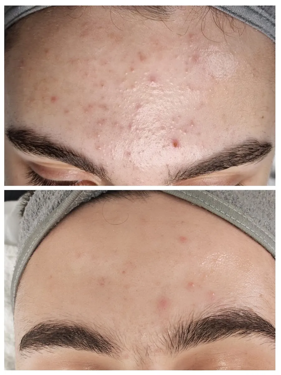 קוסמטיקאית שני גת לייזר Shani cosmetics, תמונה 8