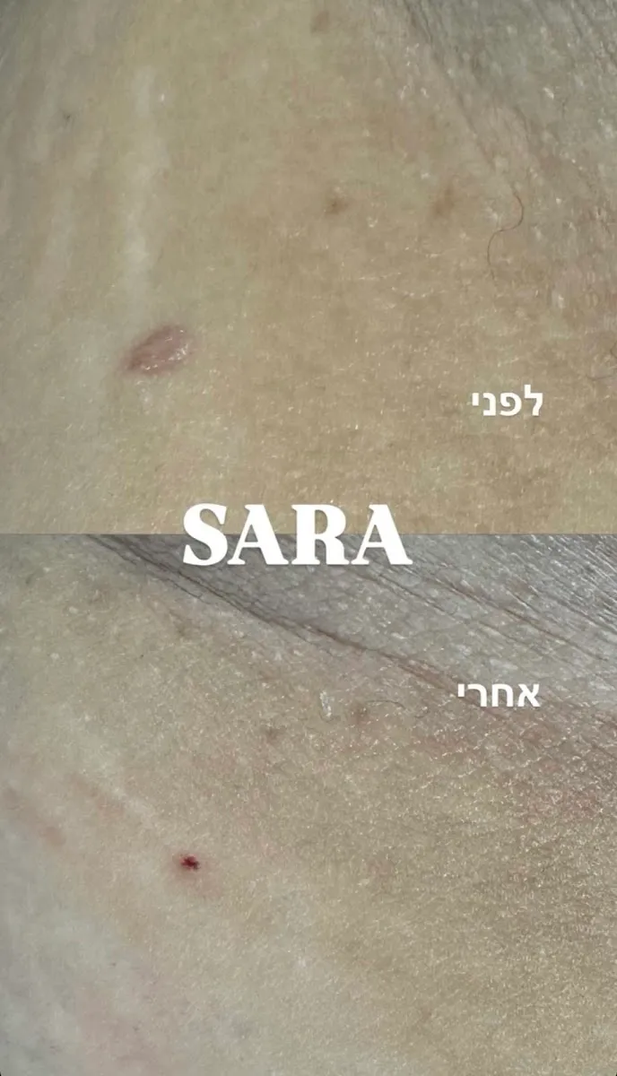 שרה שמחה - קוסמטיקה רפואית טיפולי פנים מתקדמים, תמונה 5