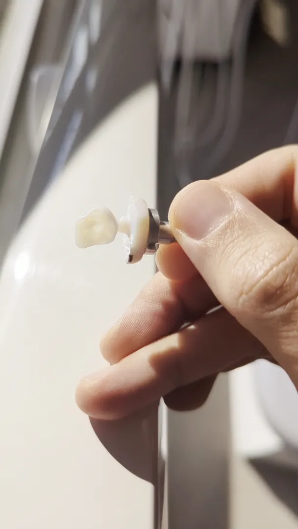 Aesthetic Dentistry - ד''ר אילן הכט, תמונה 8