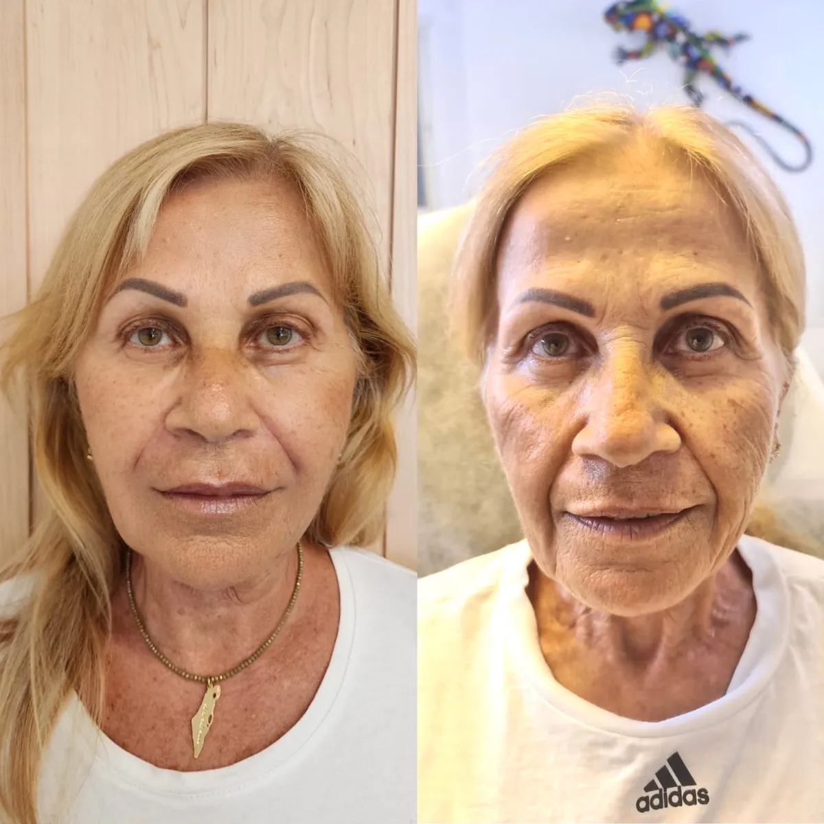 Leading aesthetic clinic - Dr. Shapiro, תמונה 4