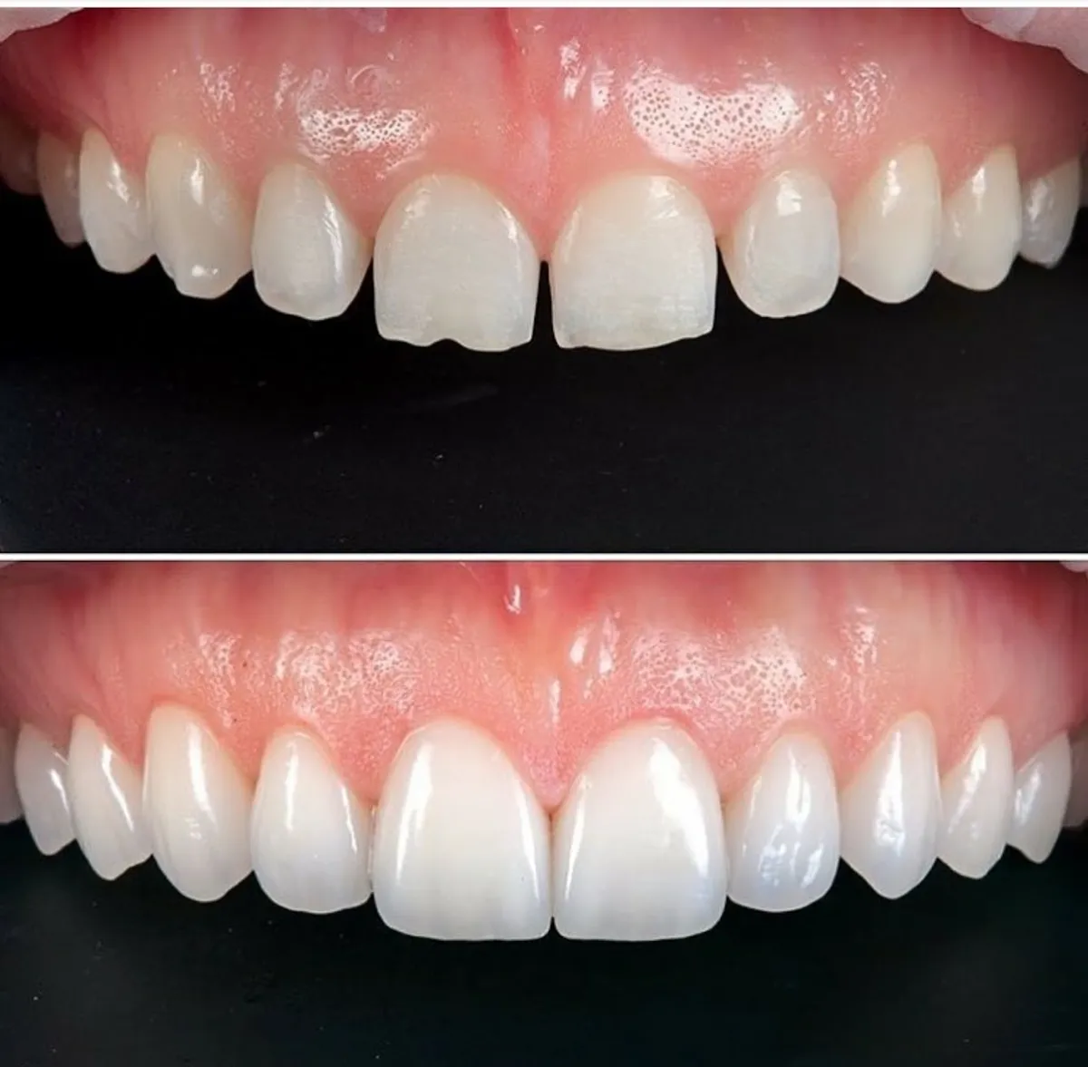 Dr Haim Aseriel Dentist, תמונה 7