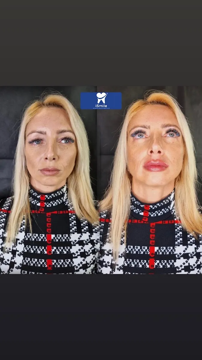 ד״ר אמיר מטר,מרפאת שיניים ואסתטיקה, תמונה 6