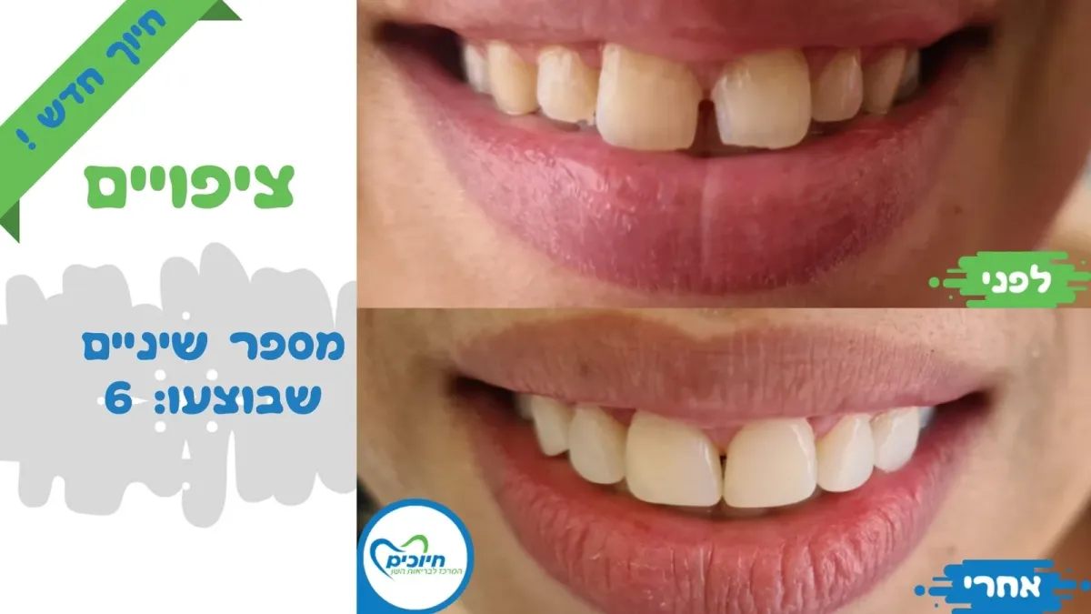 מרפאת חיוכים: תמונה 8
