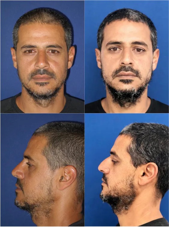 מרכז הרפואי דר׳ מרקוס הראל: תמונה 4