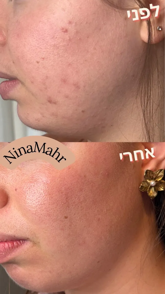 נינה מאר - קוסמטיקה טבעית מתקדמת, תמונה 6