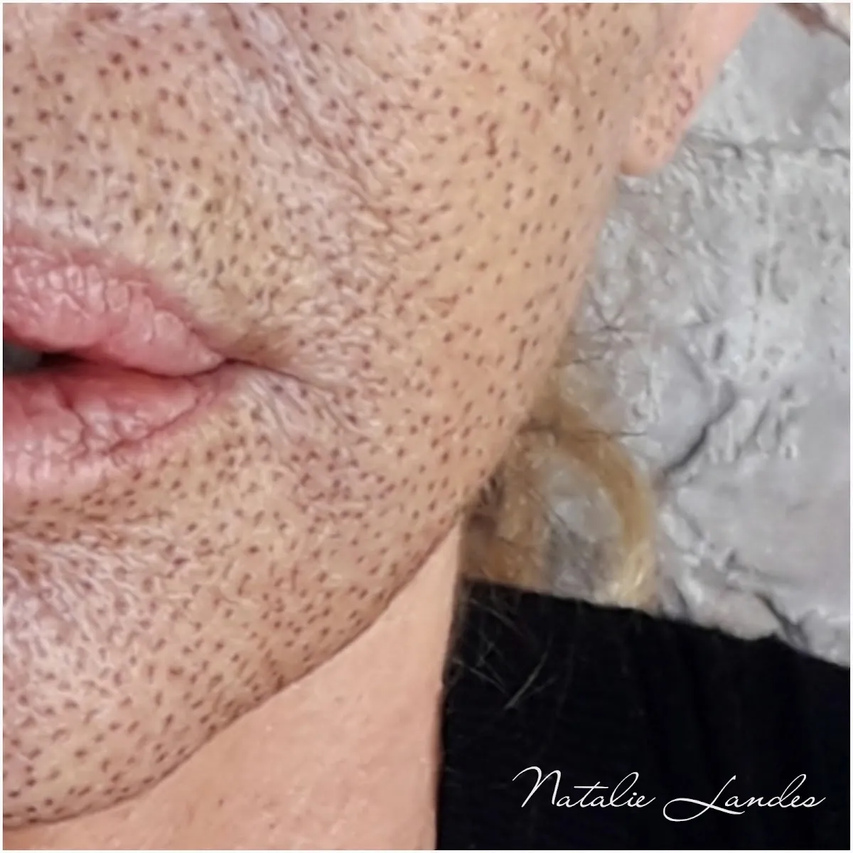 Natalie landes מרכז הדרכה לקוסמטיקאיות | רופאי עור | קליניקה לשיקום והצערת העור, תמונה 8