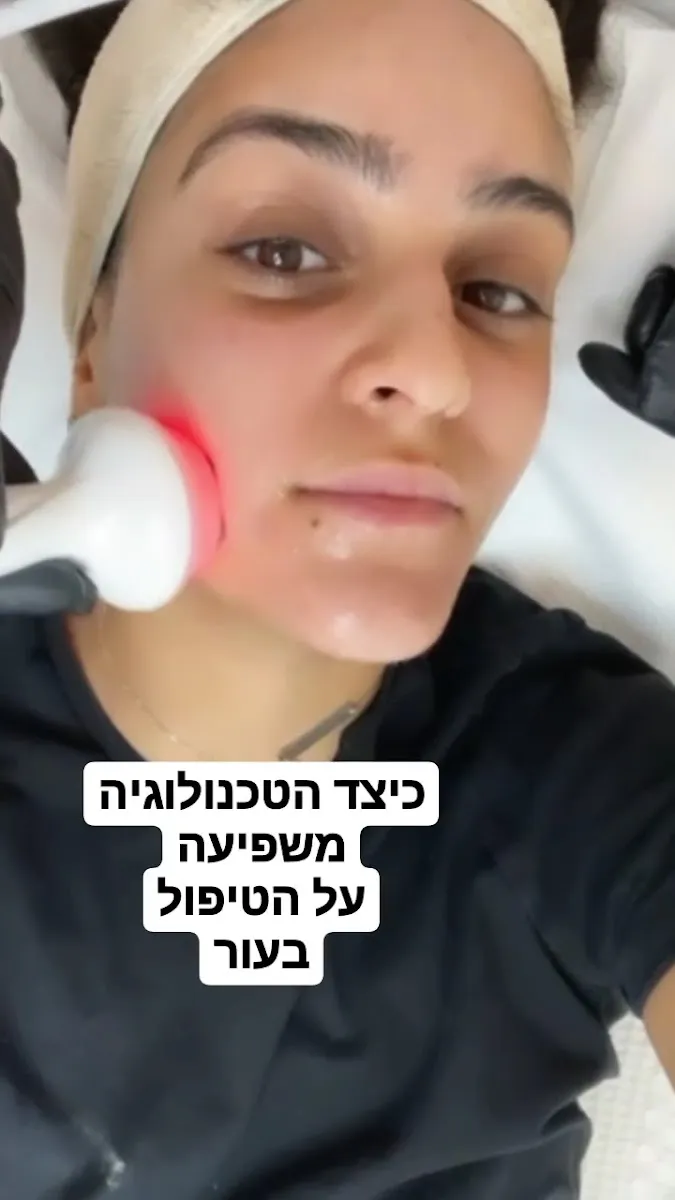 מעיין שחם רביב, תמונה 7