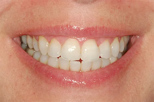Dr. Gal Rosen dental specialists: תמונה 8