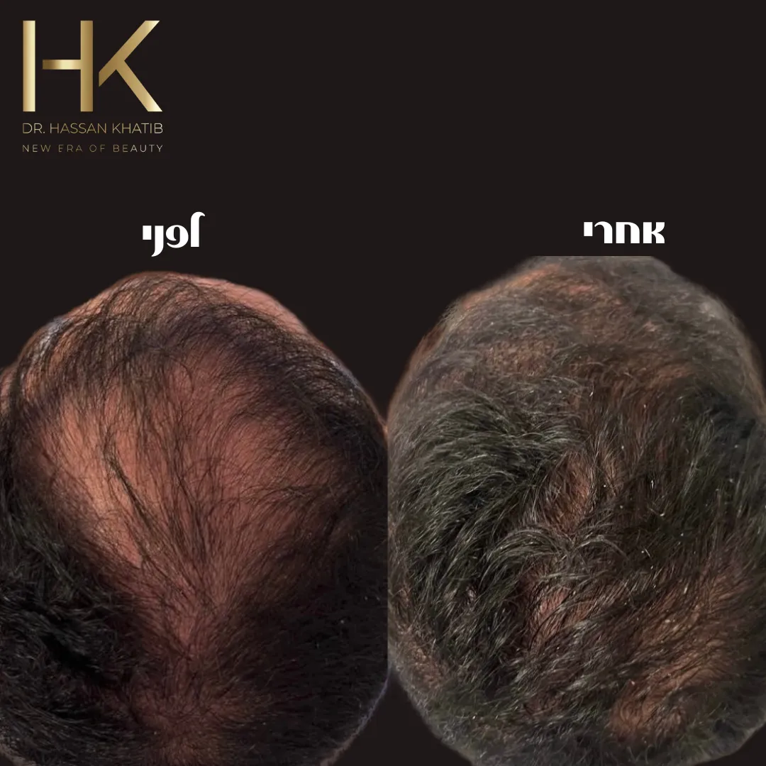 ד״ר חסן חטיב - קליניקה לרפואה אסתטית, תמונה 7