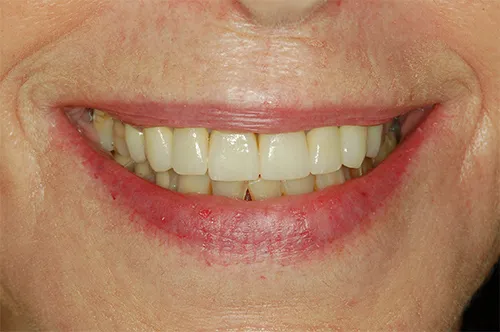 Dr. Gal Rosen dental specialists: תמונה 5