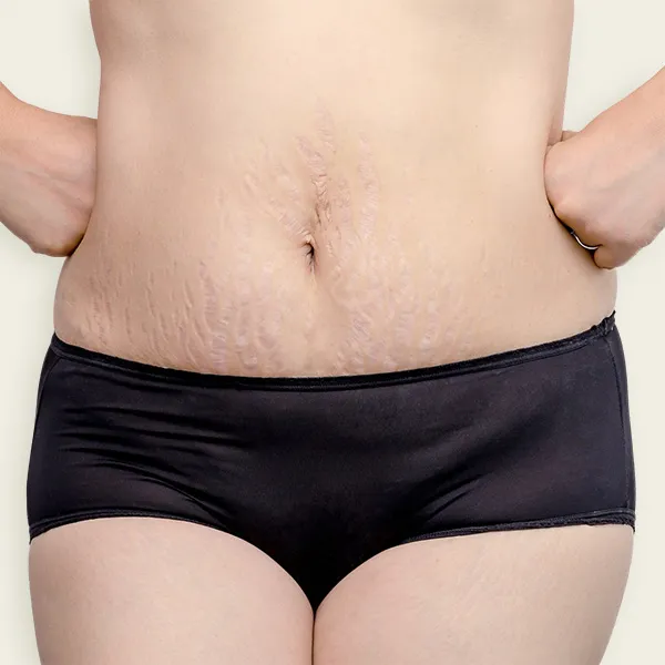 ZOI Med Aesthetics - מרפאת זוי, תמונה 4