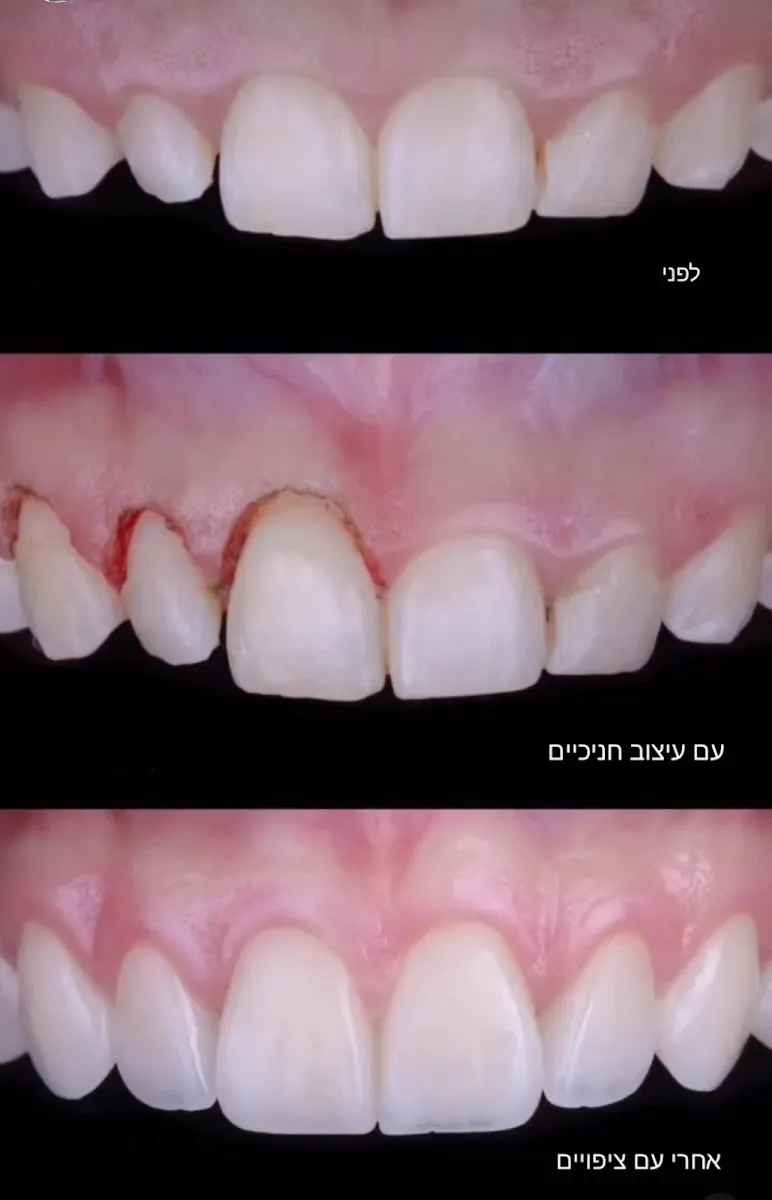 מרפאת שיניים דנטלב: תמונה 5