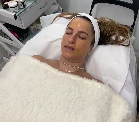 קליניקת ויקה קוסמטיקה מתקדמת | קוסמטיקאית רפואית, תמונה 5