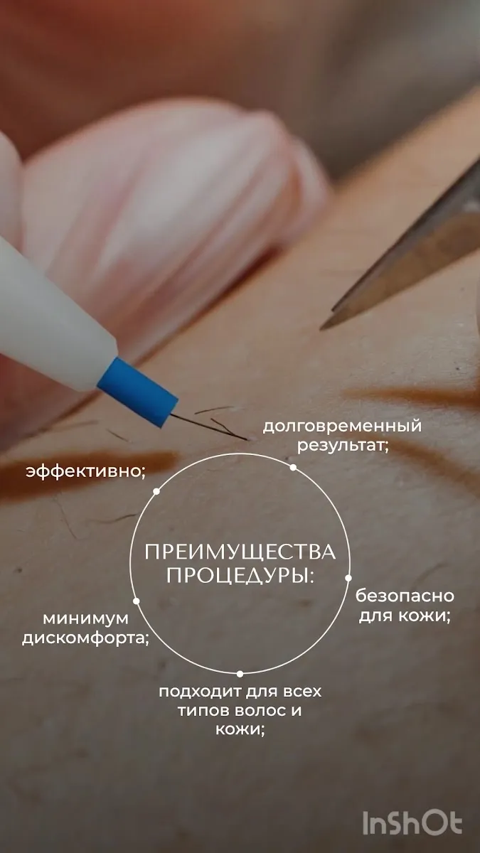 קוסמטיקאית, אלקטרולוג, עיסוי פנים Косметология, массаж лица, World_tali, תמונה 4