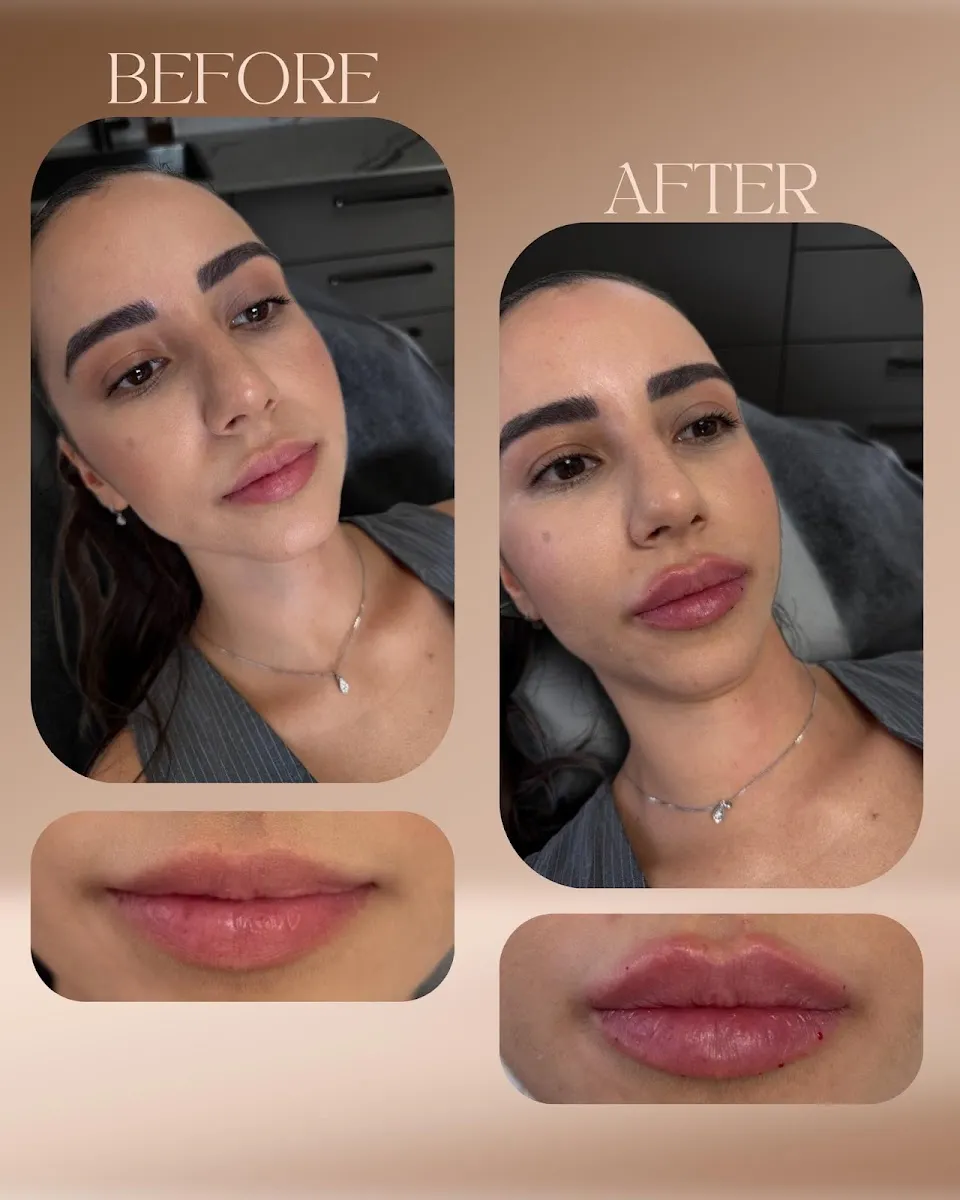 מלכת השפתיים ד"ר מריה זלטקובסקי MEDICAL AESTHETICS, תמונה 3