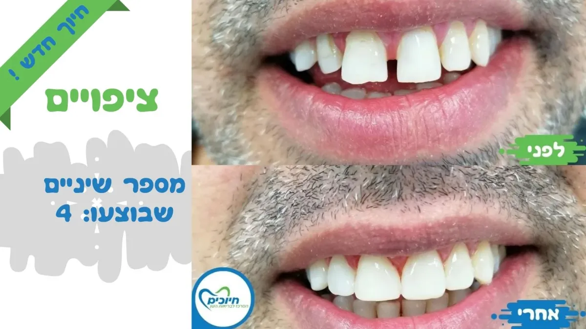 מרפאת חיוכים: תמונה 4