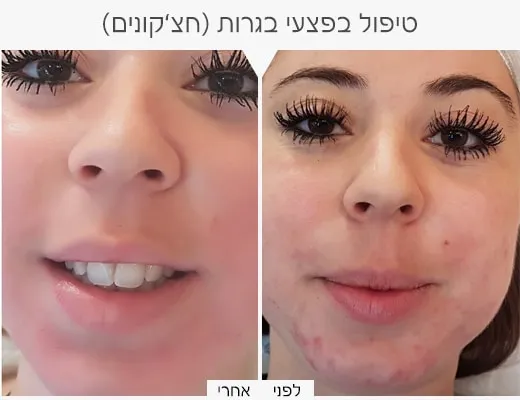כרמי קוסמטיקה רפואית, תמונה 8