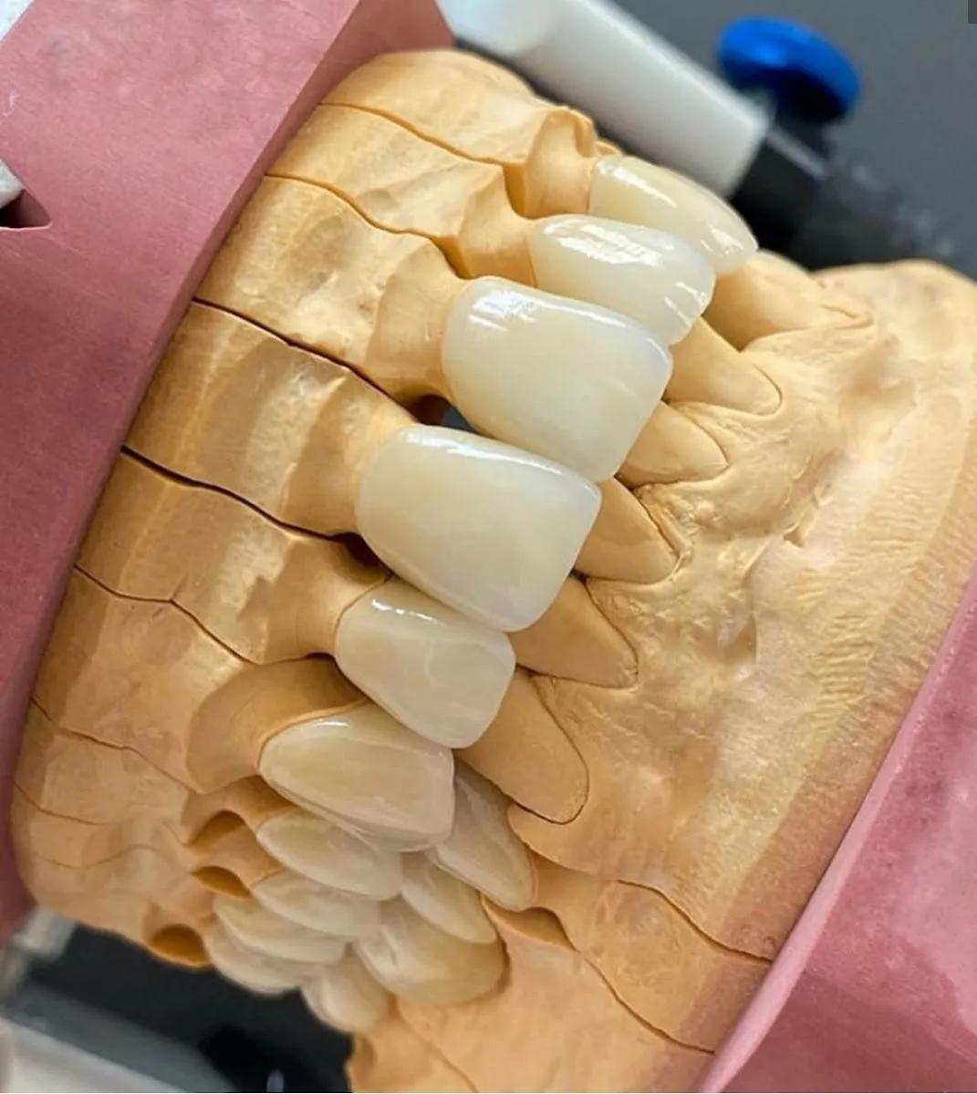 Dr Haim Aseriel Dentist, תמונה 8