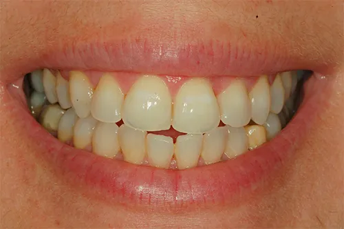 Dr. Gal Rosen dental specialists: תמונה 7