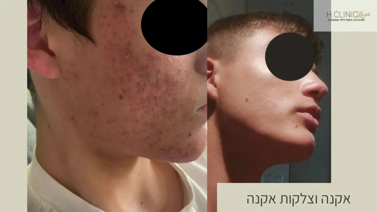 H.Clinic | לייזר ואסתטיקה, תמונה 4