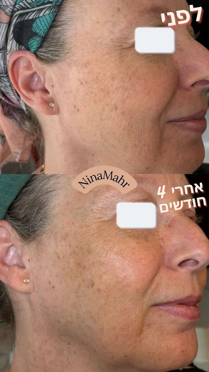 נינה מאר - קוסמטיקה טבעית מתקדמת, תמונה 7