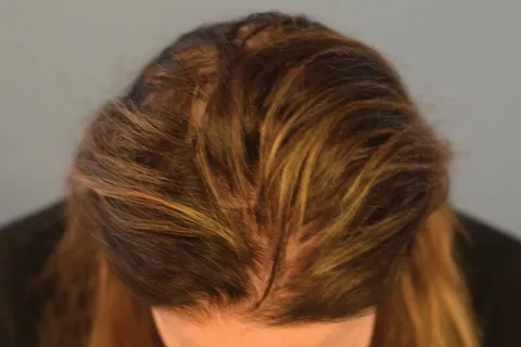 ד"ר צחי שלקוביץ' רופא עור, תמונה 5