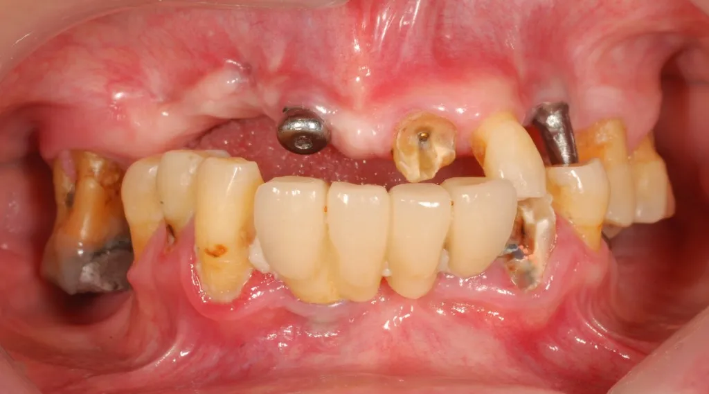 Dr. Samuel Morgolis oral: תמונה 7