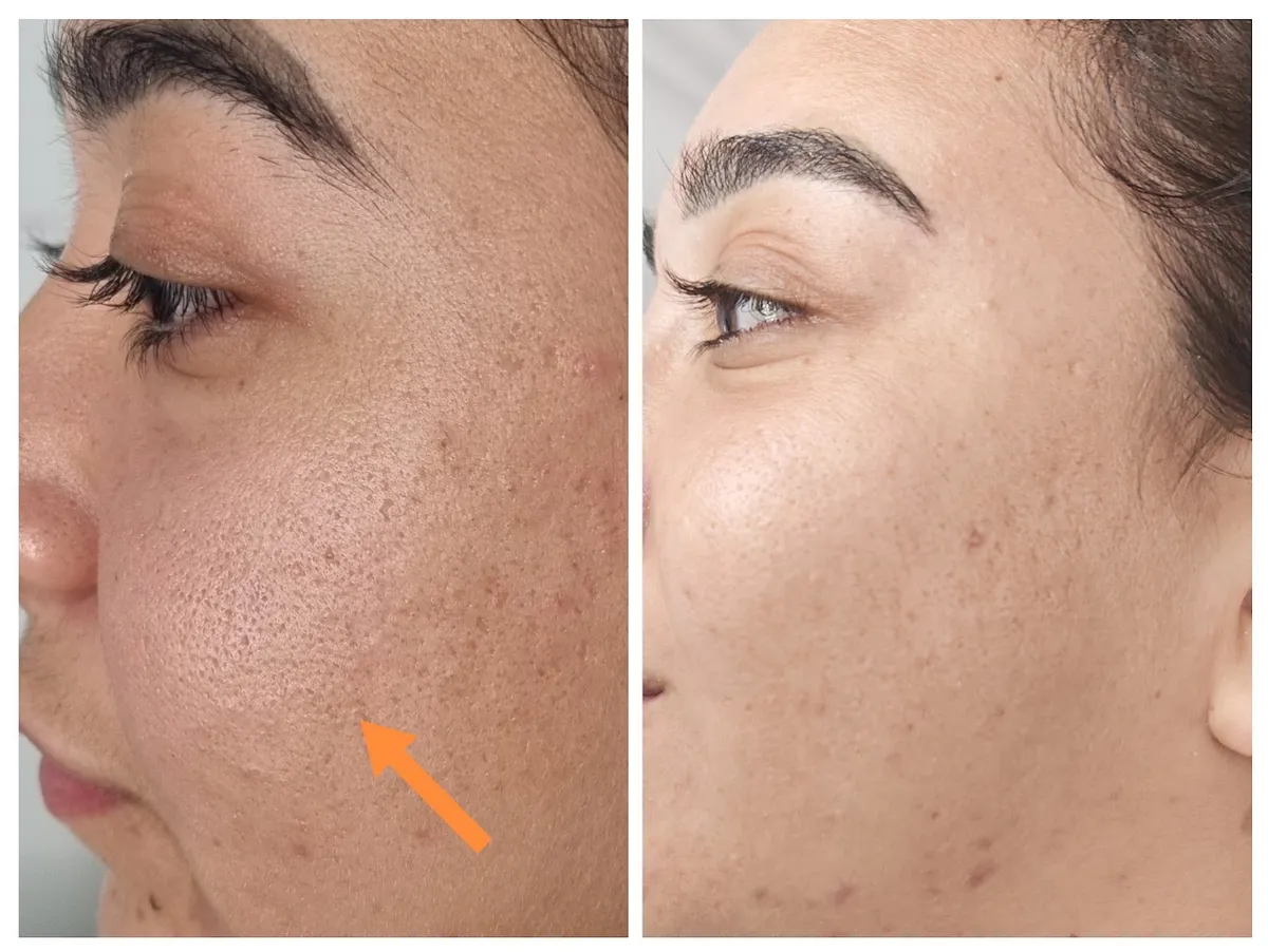 קוסמטיקאית שני גת לייזר Shani cosmetics, תמונה 4