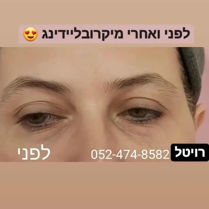 Revistyle, תמונה 5