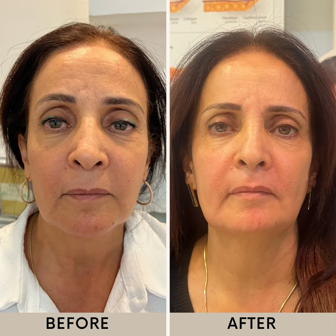 VIRGINIE institut de beauté וירג'יני קוסמטיקה מתקדמת ליופי ובריאות, תמונה 5