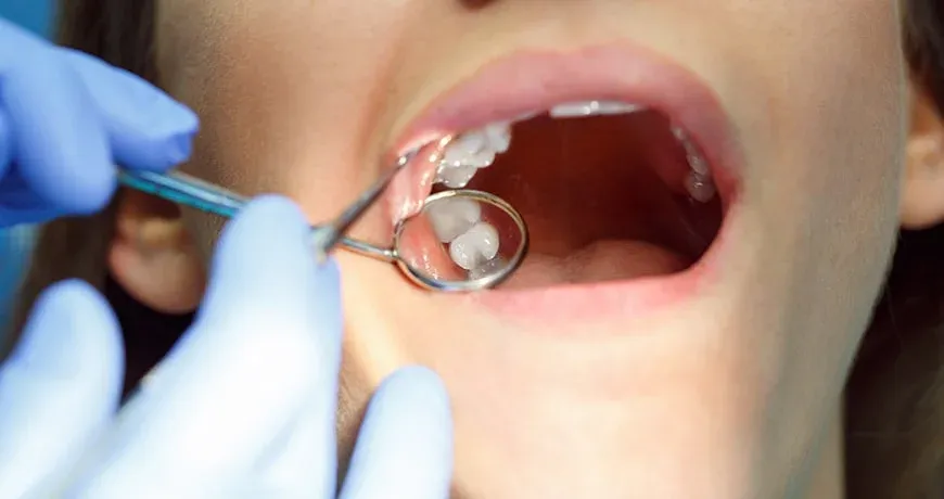 Smile Center Dental Clinic Dr. David Attia, תמונה 4