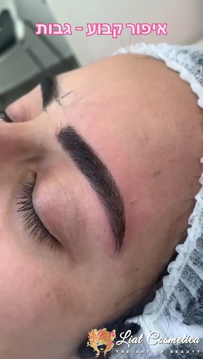ליאת ועקנין | Liat Vaknin | Advanced Skin Solutions, תמונה 4