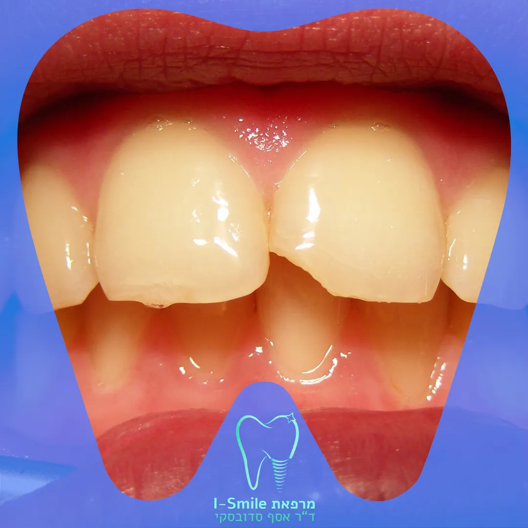 ד"ר אסף סדובסקי מרפאת שיניים בירושלים Dr.Sadovsky Jerusalem Dentist, תמונה 7