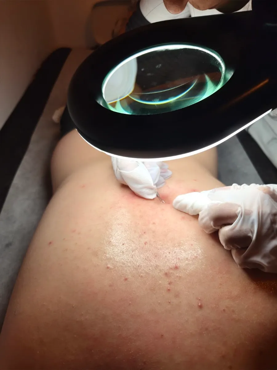 RN laser cosmetic, תמונה 7