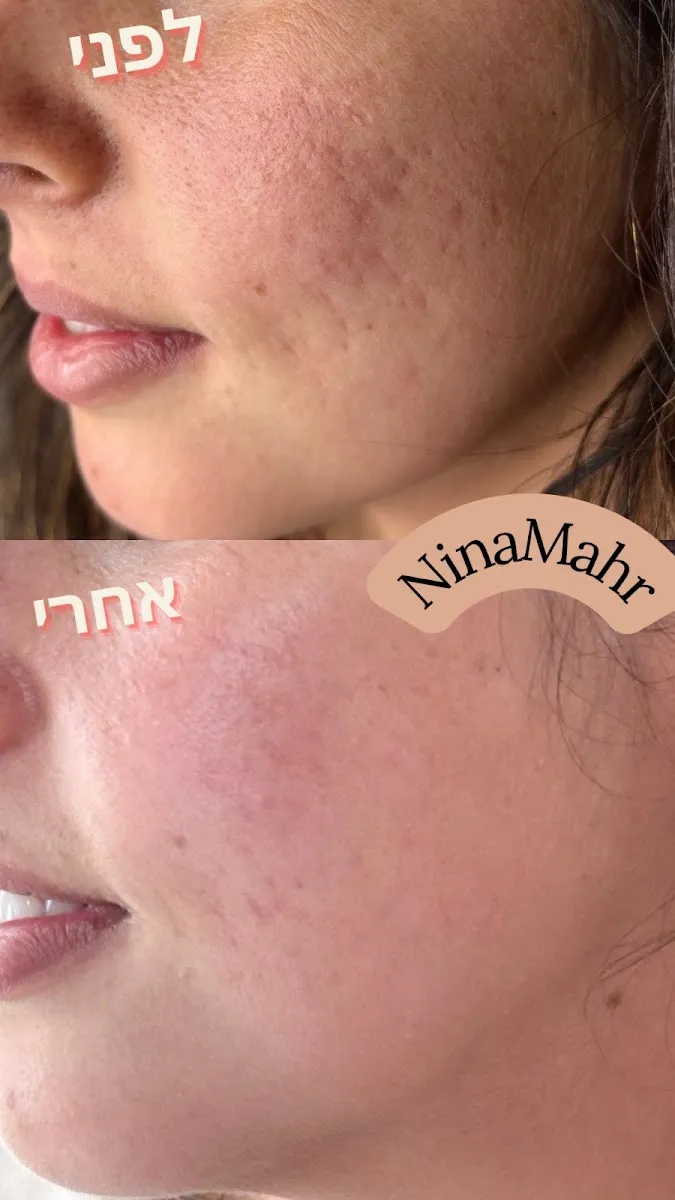 נינה מאר - קוסמטיקה טבעית מתקדמת, תמונה 5