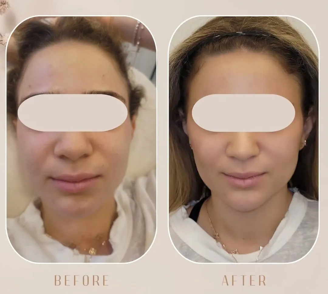 Miracle Aesthetic & Beauty Clinic: תמונה 8